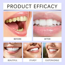 Color-Correcting Teeth Whitening Strips - Goodbye Yellow, Hello Bright